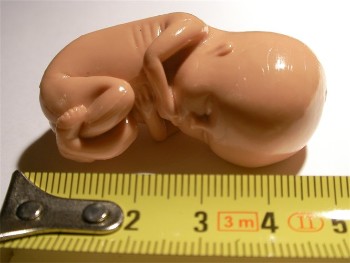 Modelo a tama�o real enviado por la inicitaiva Beb�-A�do.