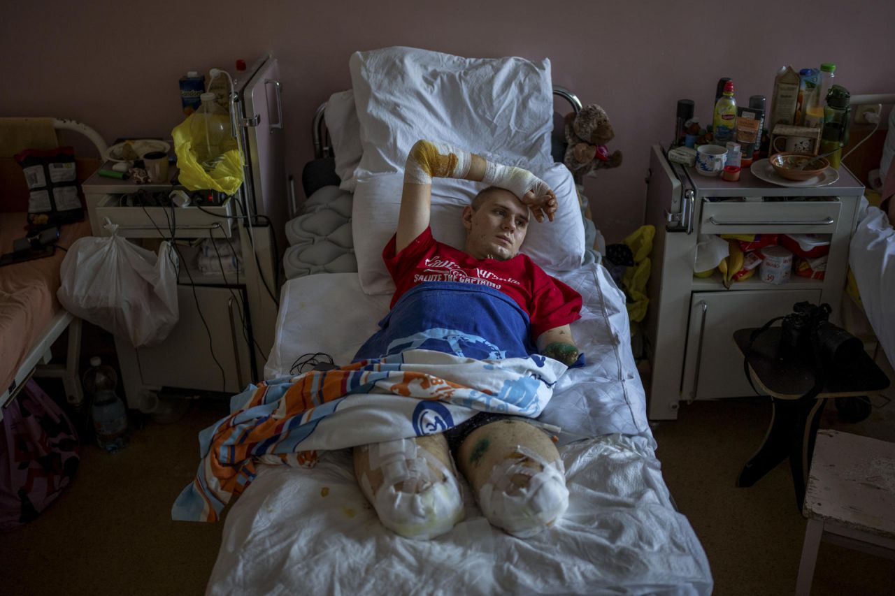 Fotografía que forma parte del proyecto fotográfico "Heridas de guerra" del fotógrafo español Emilio Morenatti,