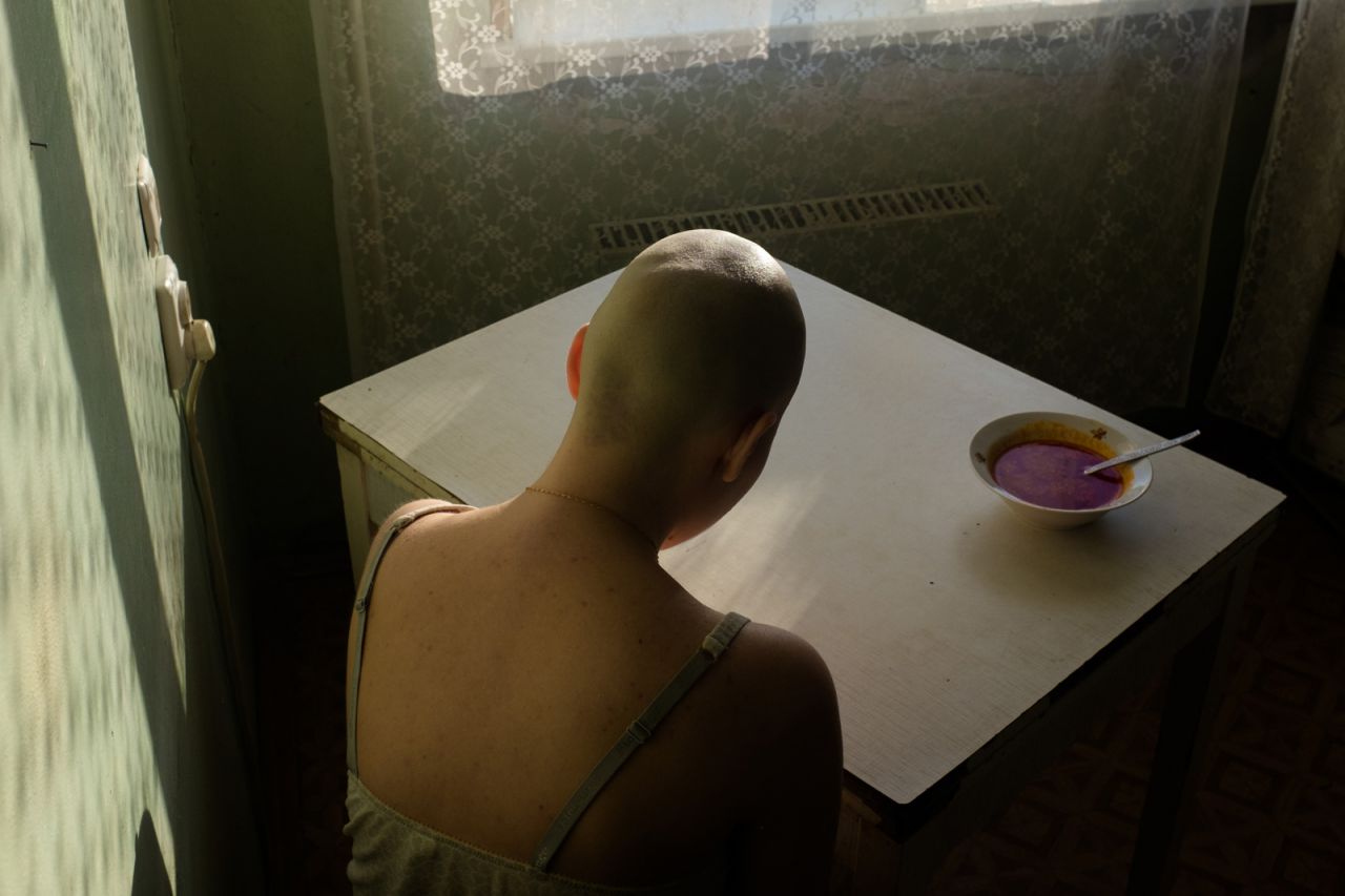 Alyona Kochetkova se sienta en casa, sin poder enfrentarse al borscht (sopa de remolacha), su comida favorita, durante el tratamiento para el cáncer.