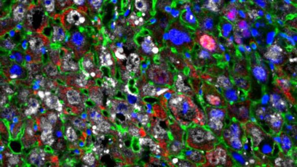 Consiguen regenerar las células dañadas del hígado a un ritmo sin precedentes