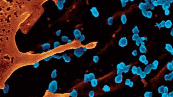 Avances en la vacuna contra el virus chikungunya