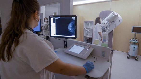 La Federación de Cáncer de Mama pide que las mamografías de cribado se hagan a partir de los 45 años
