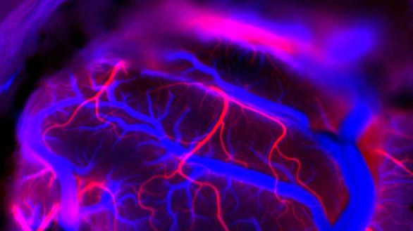 El chip de Neuralink, un paso más en la carrera por el control de la neurotecnología