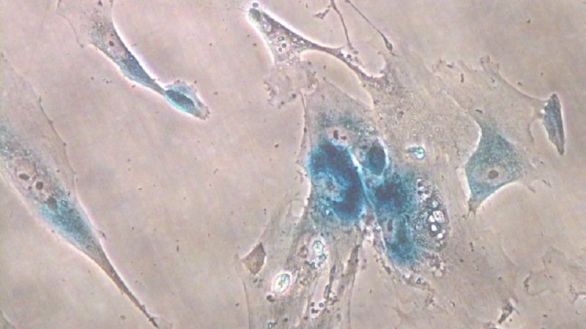 Así influyen las 'células zombies' en el envejecimiento del cuerpo humano