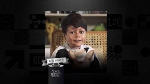 The Best: el momento en que un niño despierta del coma 16 días después y ve a su madre