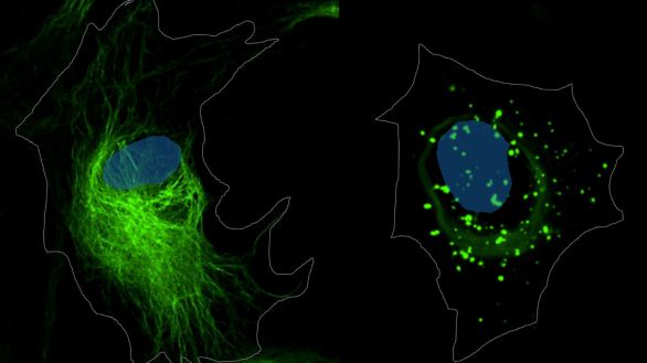Enfermedades raras: un reto para las familias, para los hospitales y para la sociedad