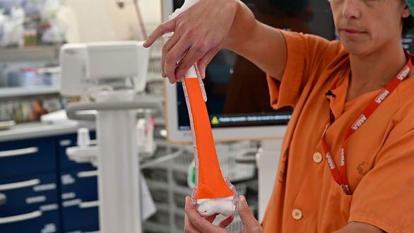 El Gregorio Marañón salva la pierna de un niño de 7 años con sarcoma gracias a una tibia de donante adulto