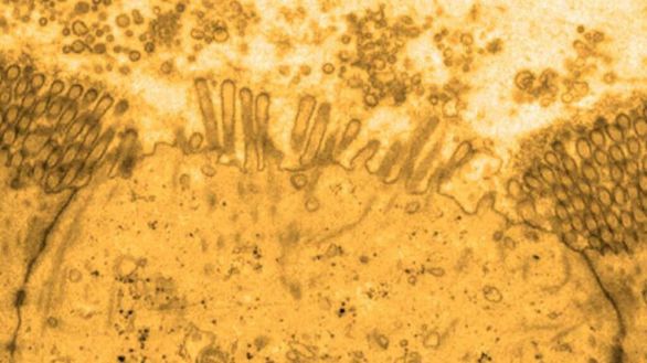 ¿Son las células M las responsables de la enfermedad celíaca?