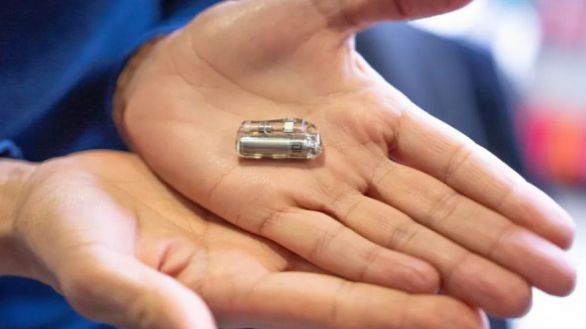 Implantan el marcapasos más pequeño del mundo a una bebé de 2,1 kg
