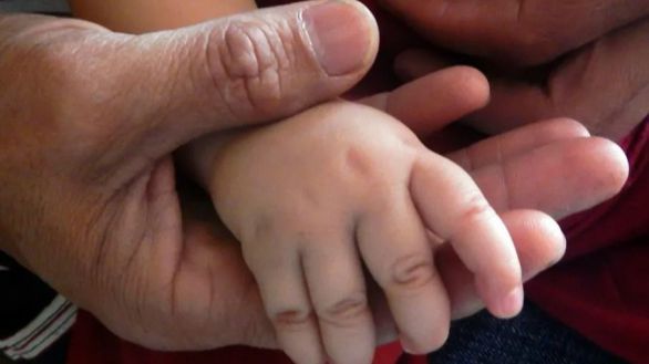 Desaconsejan exponer a recién nacidos al sol a través de las ventanas para tratar la ictericia