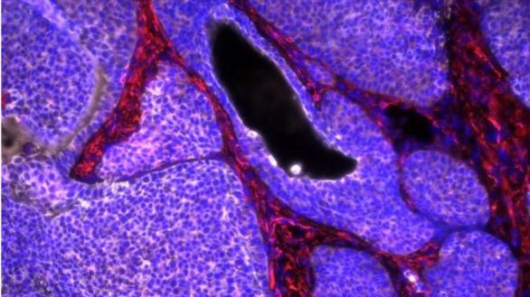 Vinculan por primera vez la exposición a un pesticida desde la infancia con el desarrollo de cáncer de colon en jóvenes