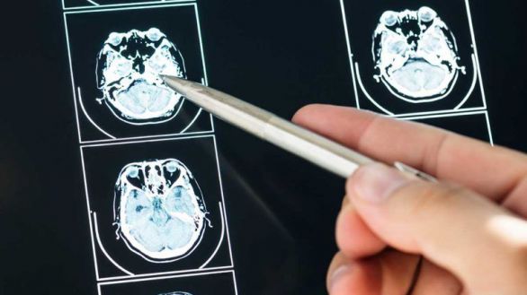 Desarrollan una plataforma que detecta el alzhéimer de forma precoz a través de la voz