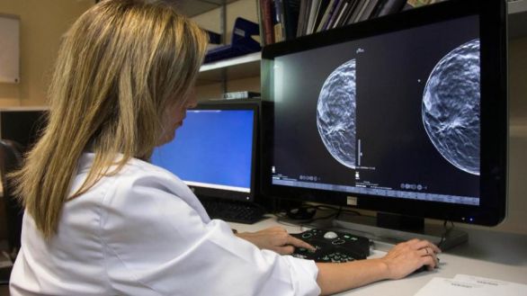 Inteligencia Artificial en los hospitales públicos madrileños para agilizar el diagnóstico de los cánceres de próstata y de mama