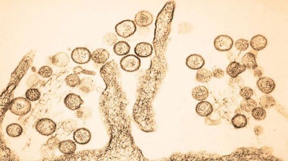 El director general de la OMS, sobre el hantavirus: "Esto no es otra Covid"