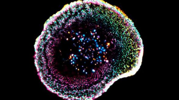 Visualizan por primera vez en 3D cómo el sistema inmune destruye células cancerosas