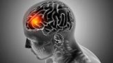 El accidente cerebrovascular es una de las enfermedades más devastadoras, que impone una grave carga a largo plazo a los pacientes, sus familias y a la sociedad, con un alto costo inherente de atención médica directa e indirecta. Imagen: kjpargeter/magnific
