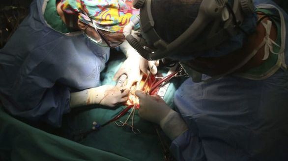 Indemnizada una mujer a la que dejaron una gasa olvidada al donar un riñón