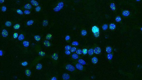 Científicos australianos explican cómo el cáncer se hace resistente al tratamiento