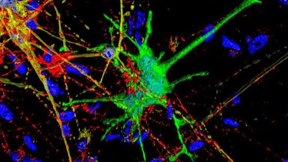 Descrita una nueva forma de estudiar el impacto del VIH en el cerebro