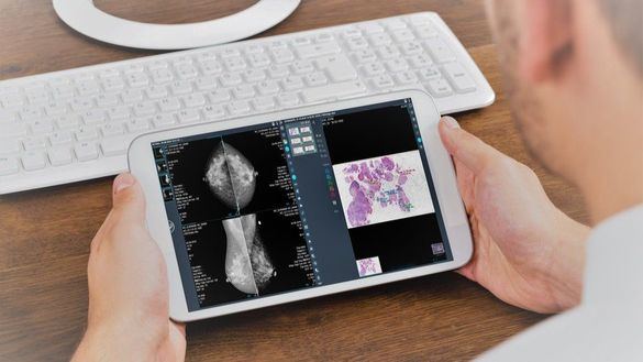 Telefónica y Dedalus se unen para impulsar la Patología Digital en España