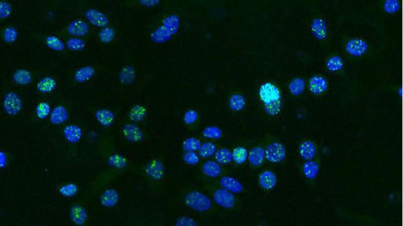 Descubren cómo el cáncer evita el sistema inmune
