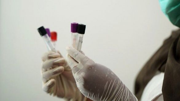 Desarrollada una nueva prueba de saliva capaz de detectar asintomáticos