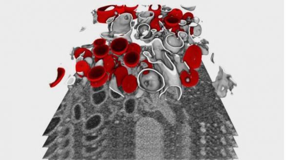 Desvelan en imágenes 3D el ciclo de replicación del virus SARS-CoV-2