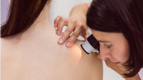 La vitamina B3 protege la piel de los rayos ultravioleta