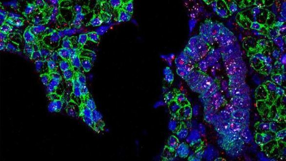 Hallan evidencias de que el coronavirus se transmite también por la saliva