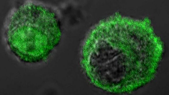 Desvelan cómo las células cancerosas producen ácido láctico para sobrevivir