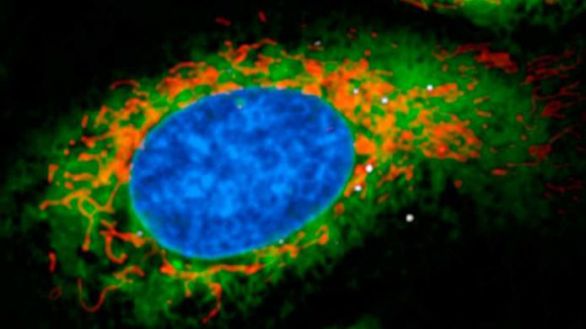 Describen cómo la bacteria ‘legionella’ engaña al sistema inmune