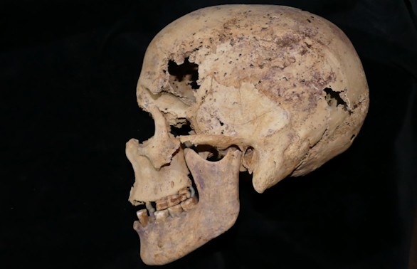 Hallada en una momia egipcia la evidencia más antigua de cáncer de mama