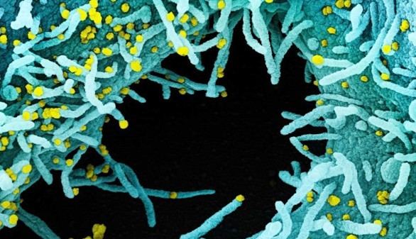 La Universidad de Harvard coordina la elaboración de un retrato del nuevo coronavirus