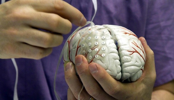 Los farmacéuticos inciden en la importancia de la prevención para combatir el ictus