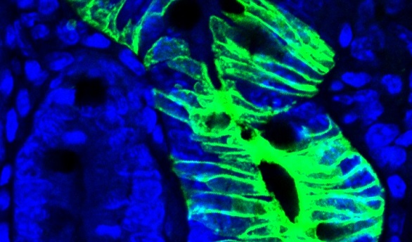 Las poderosas células madre del intestino resistentes a quimioterapia