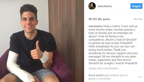 Bartra: 