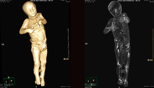 Los moldes de yeso de los habitantes de Pompeya, a vista de TAC