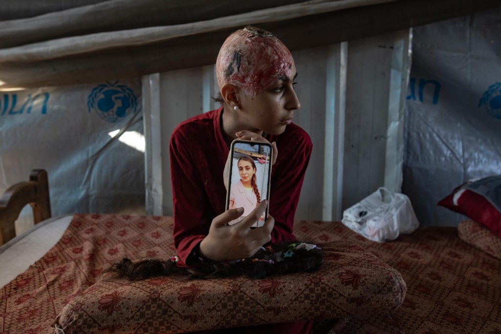 Hala Abu Dahlez, niña palestina de doce años, muestra una foto suya antes de un ataque aéreo israelí, el 6 de julio. Foto: Efe