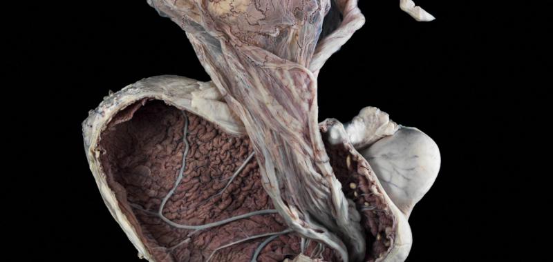 ÚTERO DE UNA YEGUA, CON EL FETO UNIDO AÚN POR EL CORDÓN UMBILICAL