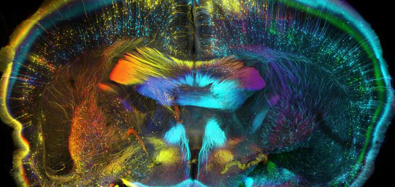 VISTA CORONAL DEL CEREBRO DE UN RATÓN