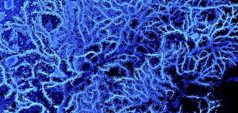 MICROGRAFÍA DE LAS DENDRITAS DE UNA CÉLULA DE PURKINJE, UN TIPO DE NEURONA