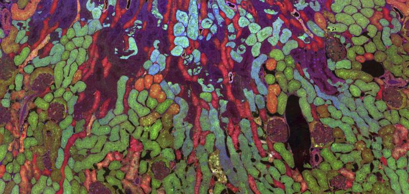DISTRIBUCIÓN DE LOS METABOLISMOS EN UN RIÑÓN DE RATÓN EN UNA IMÁGEN TOMADA POR UN MICROSCOPIO ÓPTICO