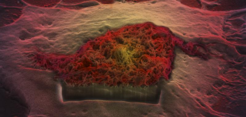 IMAGEN MICROSCÓPICA DE UN ASTROCITO DEL CEREBRO TOMANDO NANOAGUJAS DE CARBONO