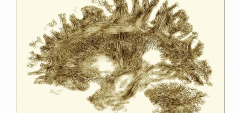 EL CEREBRO DE UN HUMANO ADULTO SANO EN UNA IMAGEN OBTENIDA A TRAVÉS DE UNA RESONANCIA MAGNÉTICA