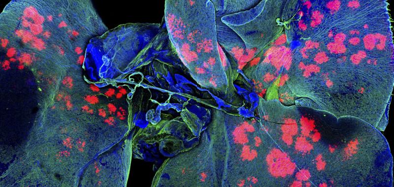 MICROPARTÍCULAS DE UN MEDICAMENTO EN LOS PULMONES DE UN RATÓN