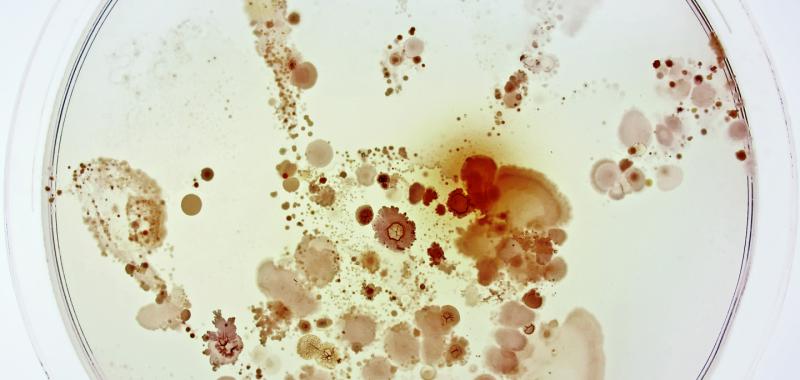 Primer premio general: ¿Qué esconde la mano de un niño?