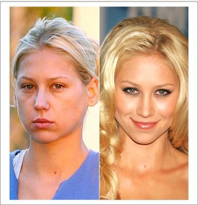 Anna Kournikova