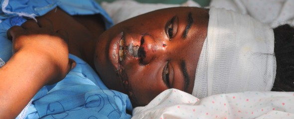 Una haitiana se recupera de sus heridas. Efe