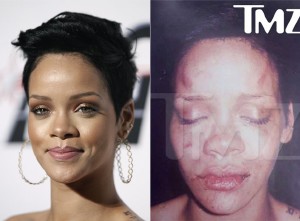 La cantante Rihanna, con su imagen habitual (i) y su aspecto tras ser agredida (d)