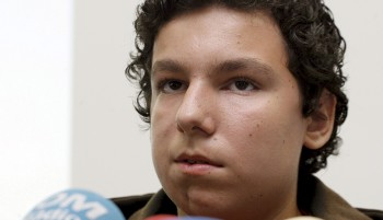 Aspecto de uno de los jóvenes que ha sido sometido al transplante de cara con células madre (Efe)